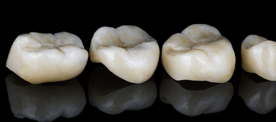 Dental Crown